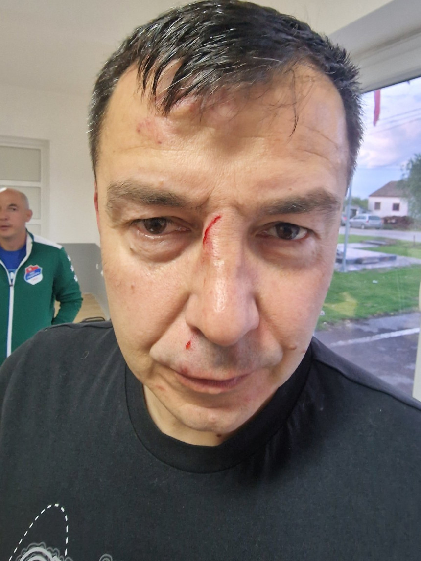 Тројица ухапшена због напада на главног судију