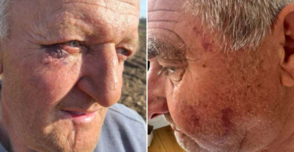 Бањалука: Полицијска бруталност над пензионерима?!