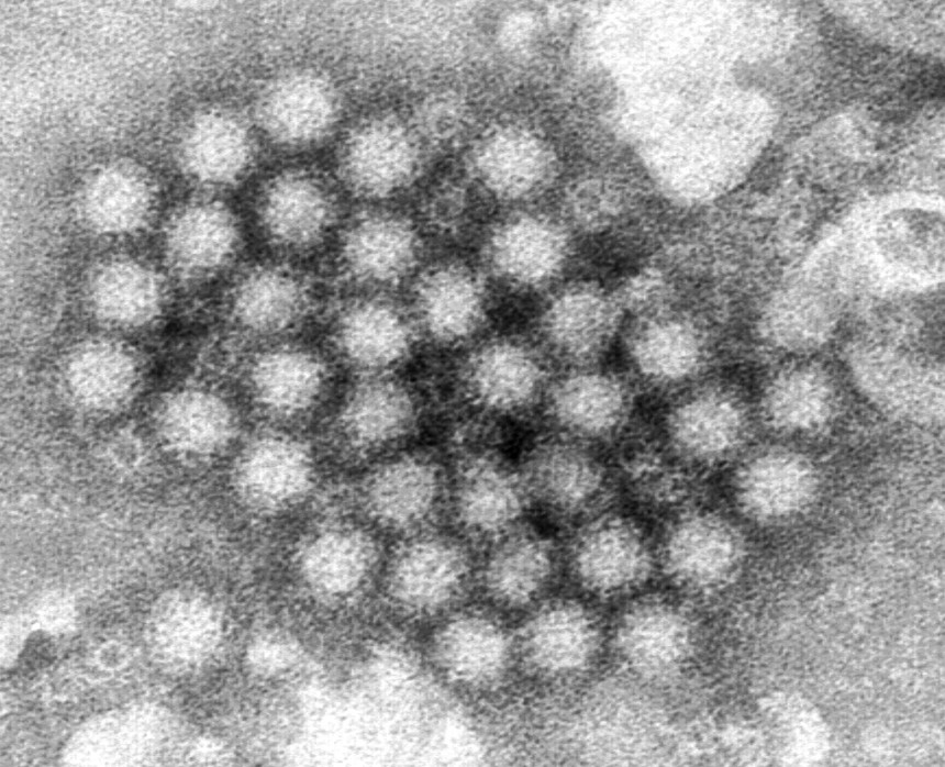 Od epidemije norovirusa na američkom kruzeru oboljeleo 115 ljudi