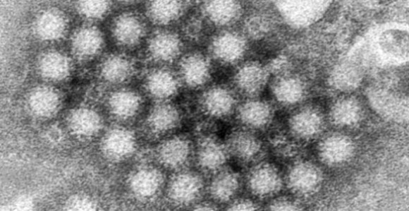Od epidemije norovirusa na američkom kruzeru oboljeleo 115 ljudi