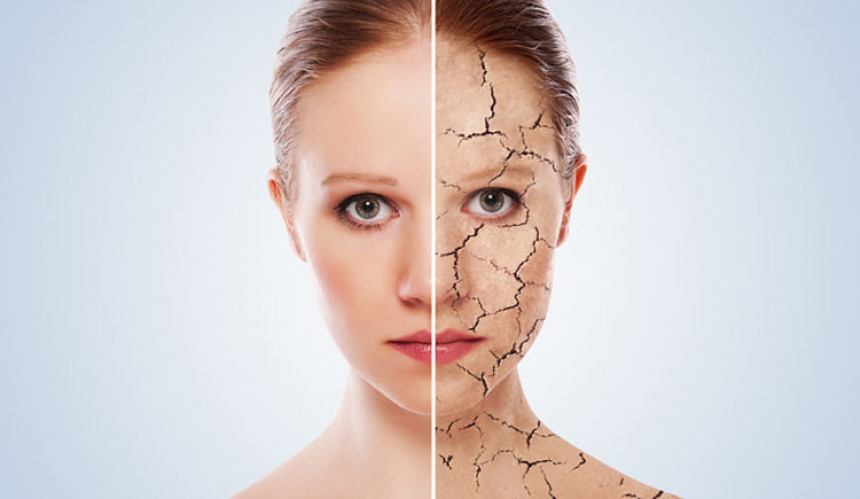 Разлика између суве и дехидриране коже