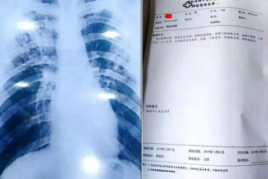 Наставник купио лажну дијагнозу туберкулозе да би продужио одмор!