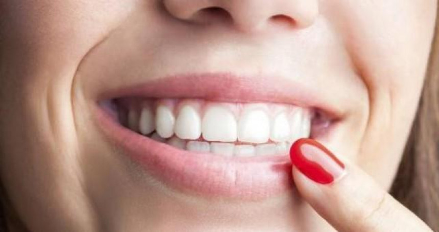 Зашто неки људи имају бијеле мрље на зубима?