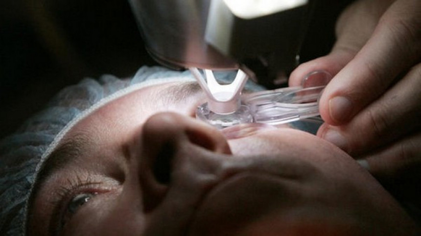 Da li je laserska operacija oka bezbjedna?