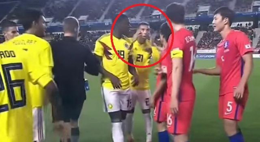Video: Kolumbijac "kosio" oči, suspendovan 5 mečeva!