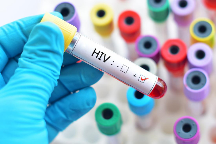 Кинески научници близу проналаска лијека за ХИВ