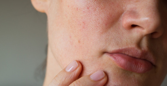 Ova promjena bi mogla biti prvi znak raka pluća