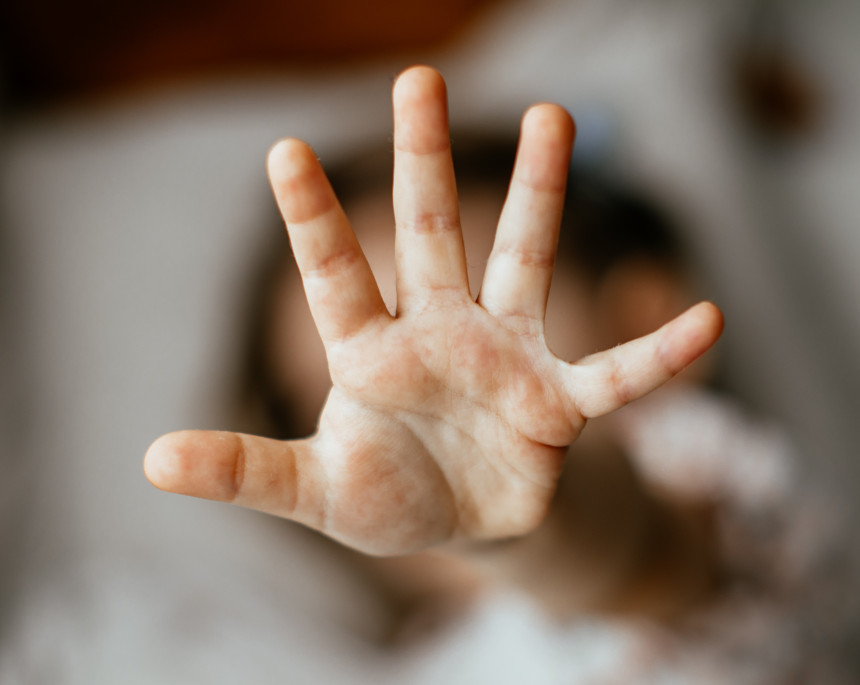 Defektolog iz BiH zlostavljao dijete sa smetnjama