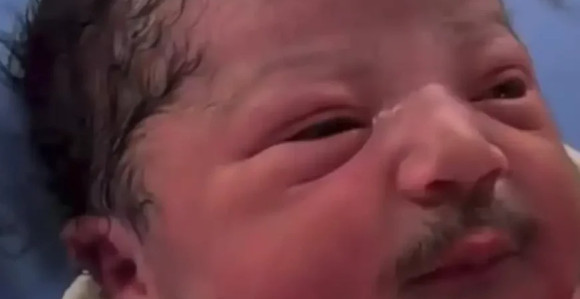 Beba rođena sa brkovima i bradom (foto, video)