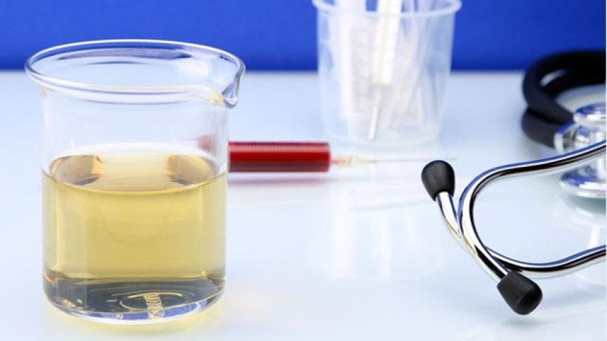 Šta vaš urin govori o vašem zdravlju?