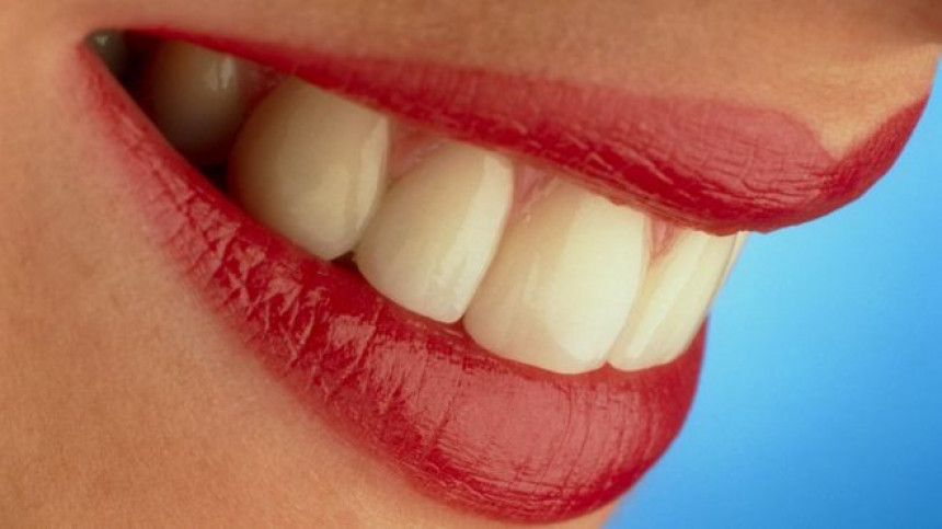 Šta stanje zuba može da otkrije?