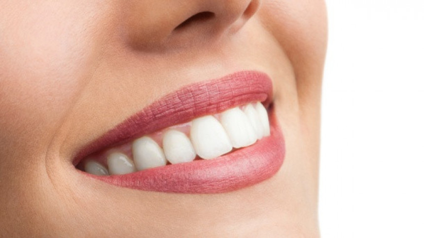 Deset stvari kojima uništavamo zube