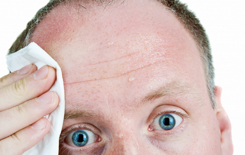 Појачано знојење може бити скривени знак болести
